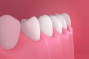 kania gum disease