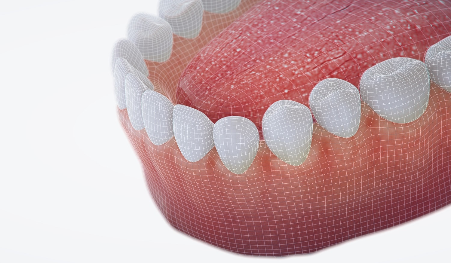 Tooth Platelets How Do Platelets Boost Your Periodontal Health? | Encinitas, CA