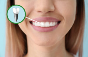 encinitas dental implants