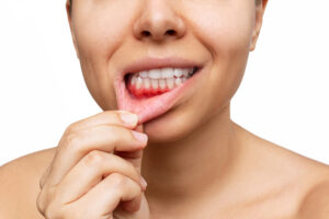 encinitas gum disease