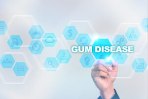 encinitas gum disease