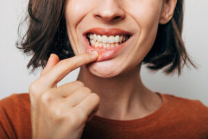 encinitas gum disease