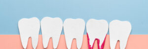 encinitas gum disease and tooth loss