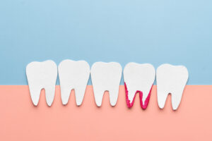 encinitas gum disease and tooth loss