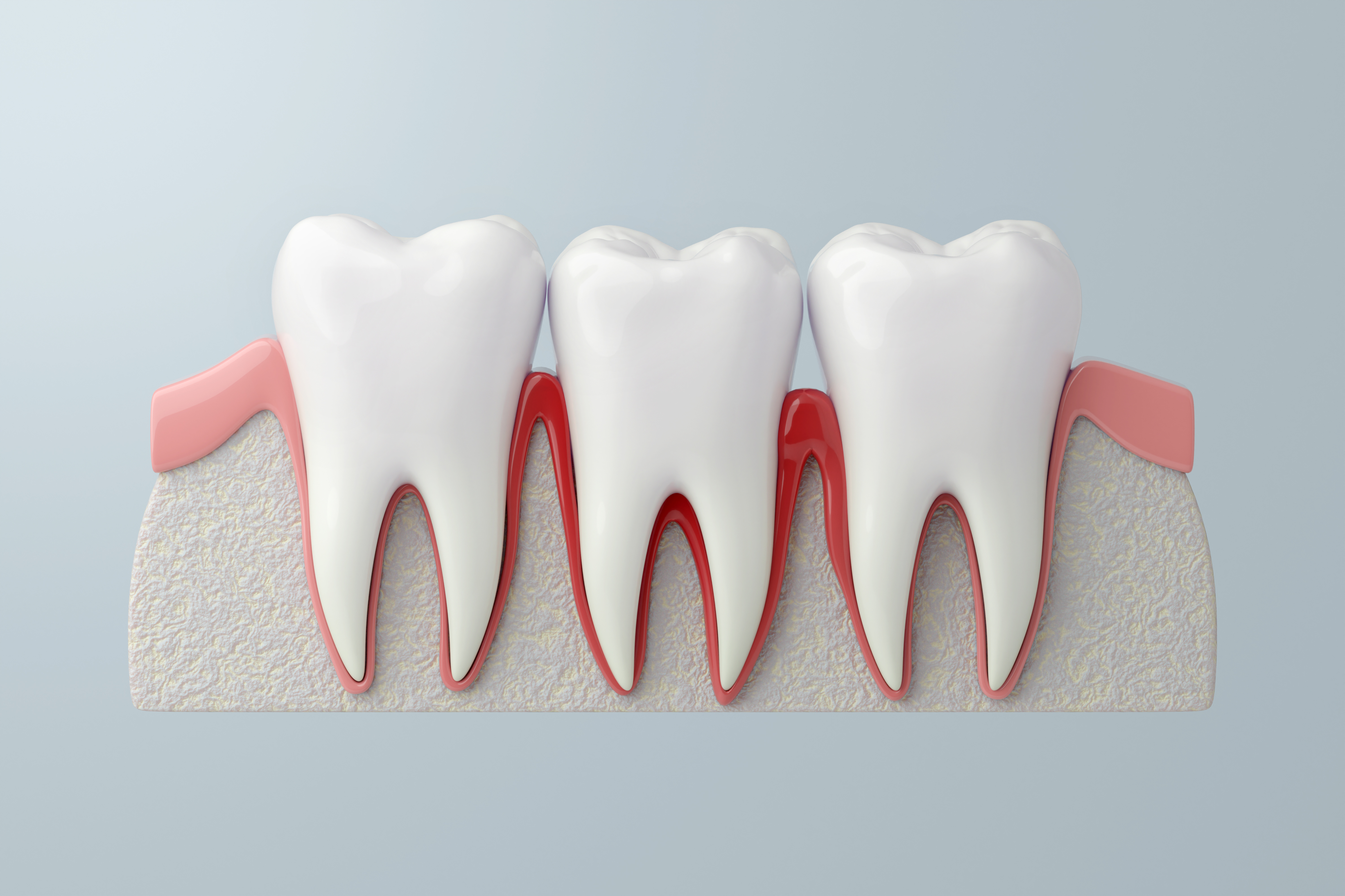 Helping Your Gums With REPAIR With WaterLase