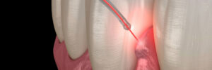 encinitas laser repair