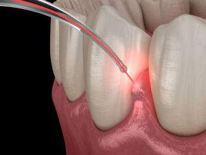 encinitas laser repair